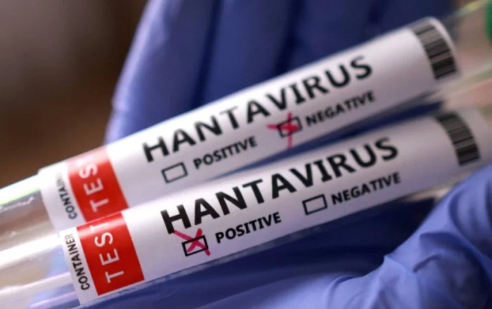 Venesuelada hantavirus həyəcanı: