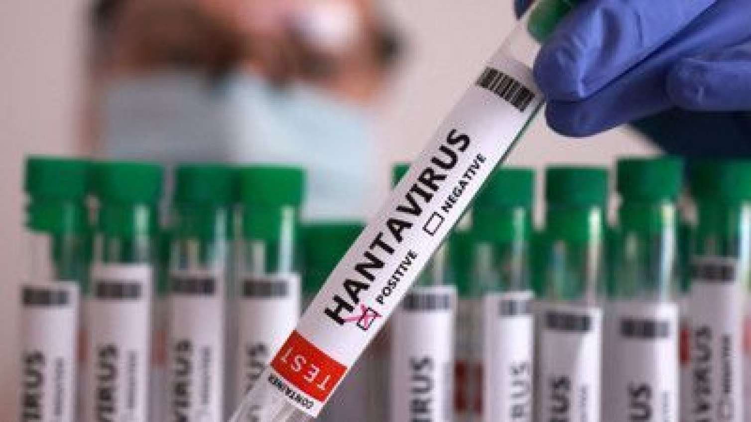 Kimlər Hantavirusa yoluxma riski altındadır?