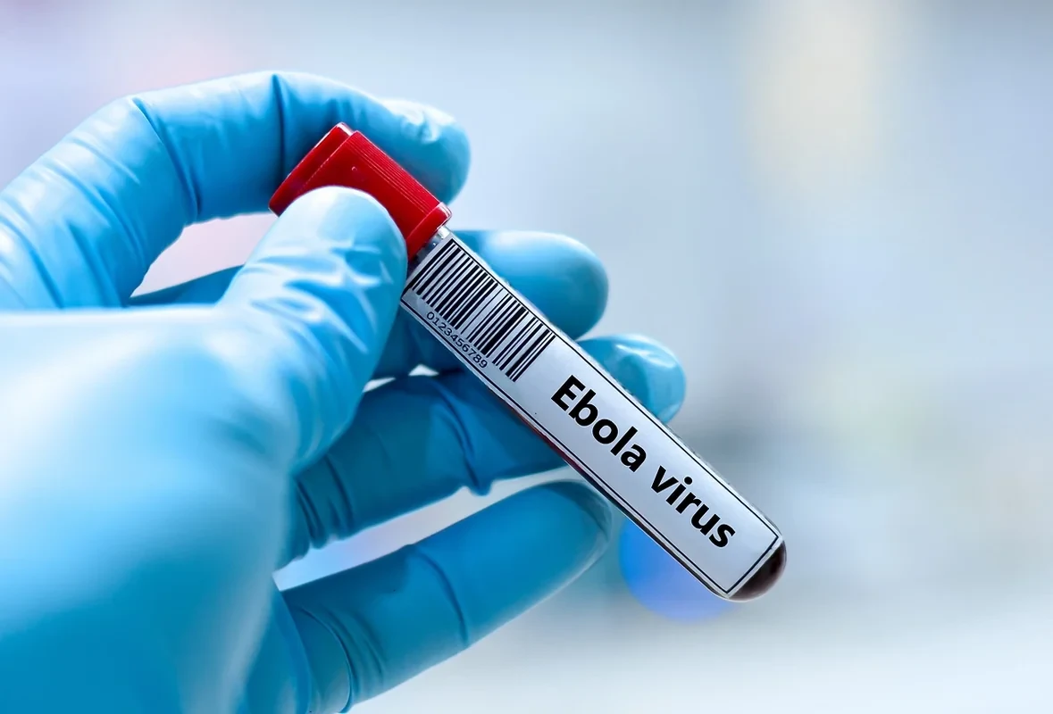 İsraildə Ebola təşvişi: Bir nəfər nəzarət altına alınıb