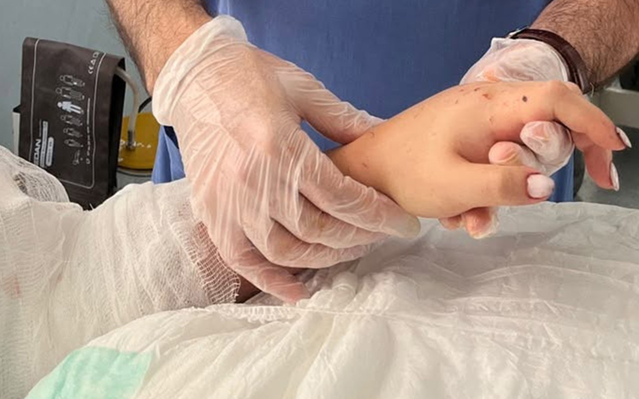 Bakıda qızın qopmuş qolu yerinə bərpa olundu -