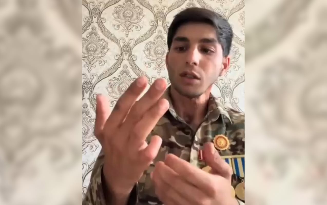 Barmaqları amputasiya olunan qaziyə niyə əlillik verilmir? -